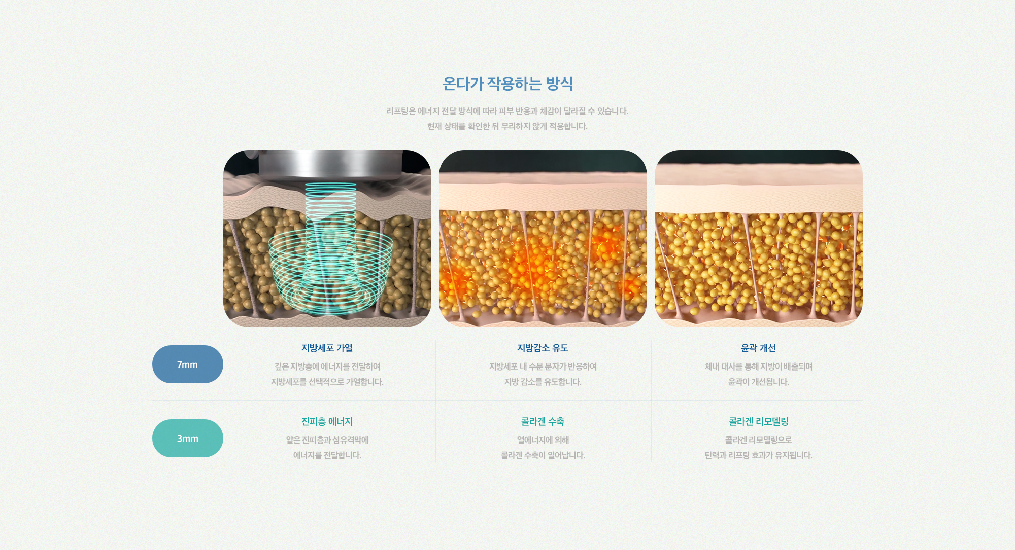 [온다가 작용하는 방식] 진피층에 에너지 집중 → 콜라겐 수축 → 콜라겐 리모델링